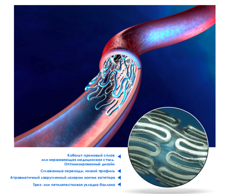 Matrix stents for peripheral and coronary arteries